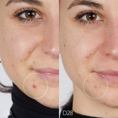 Caudalie Serum gegen Unreinheiten  Сыворотка против несовершенств