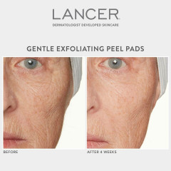 Lancer Gentle Exfoliating Peel Pads Нежные отшелушивающие подушечки для пилинга