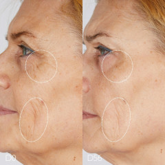 Caudalie Das Serum  Сыворотка